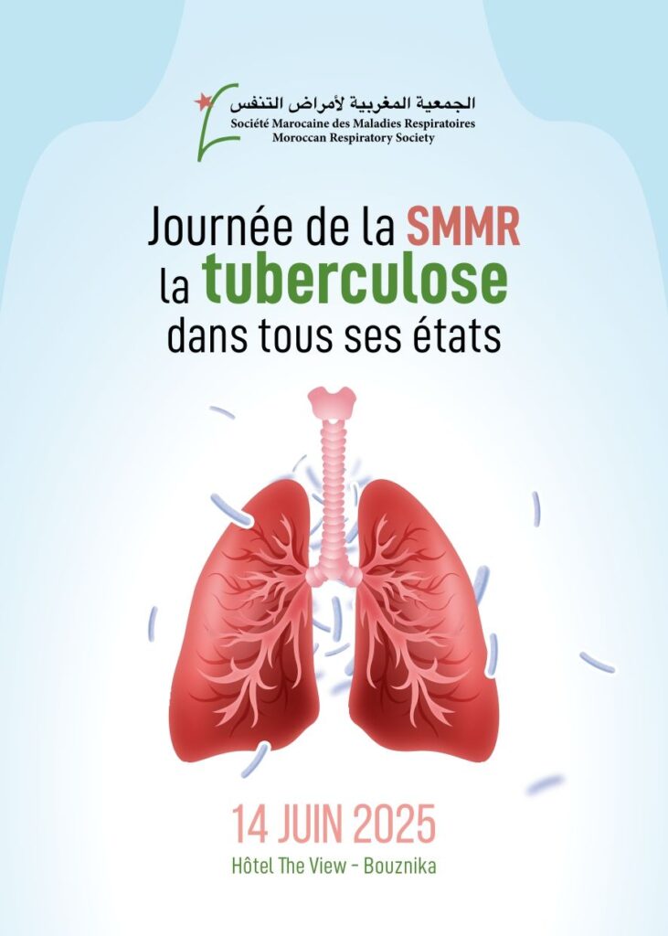 Journées de la SMMR , la tuberculose dans tous ses états